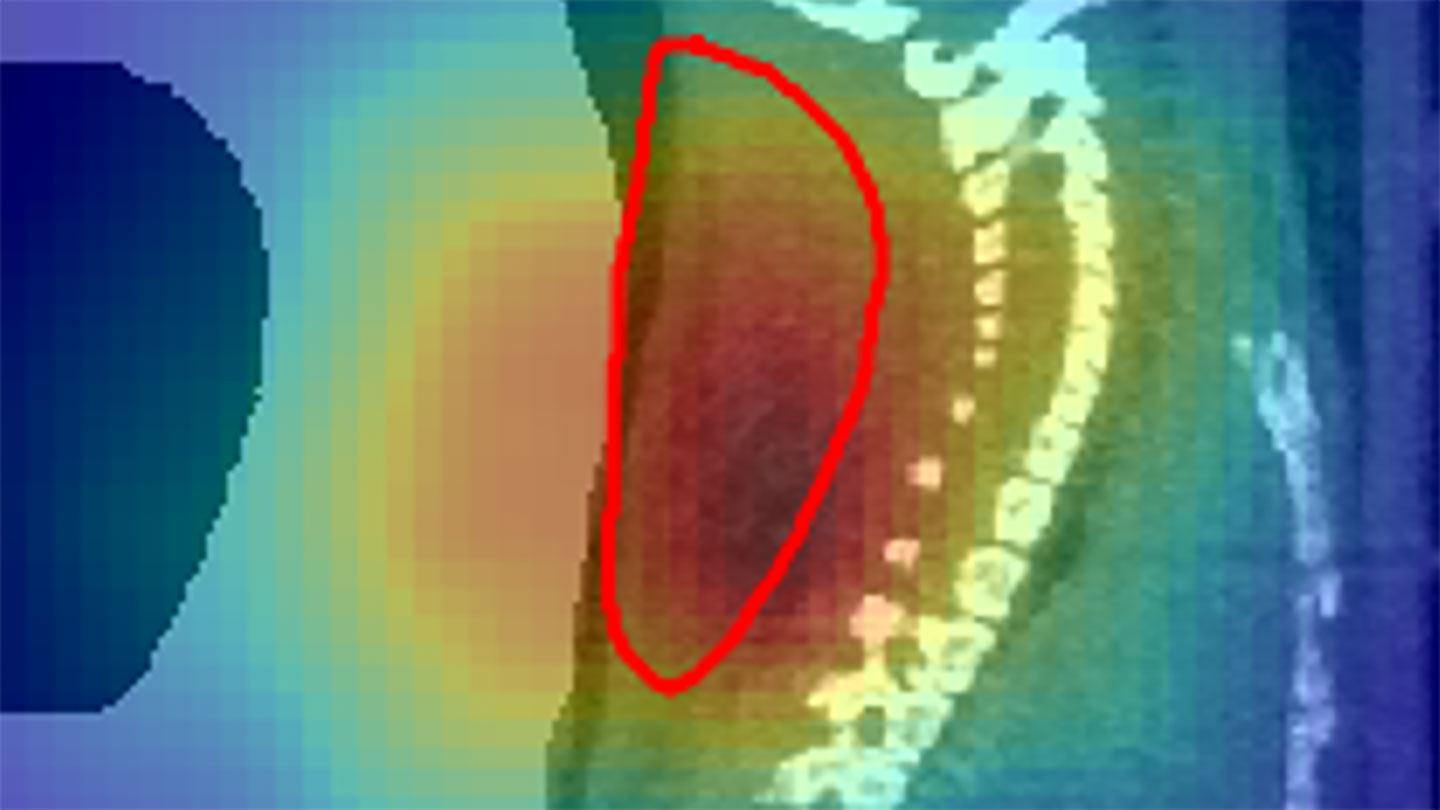 Radioactive beams give a real-time view of cancer treatment in mice