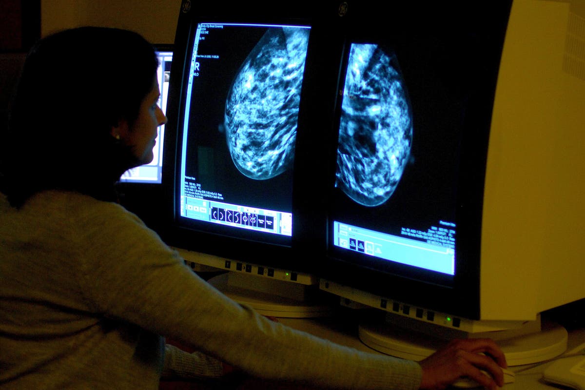 Hormonal coil may be linked to increased risk of breast cancer