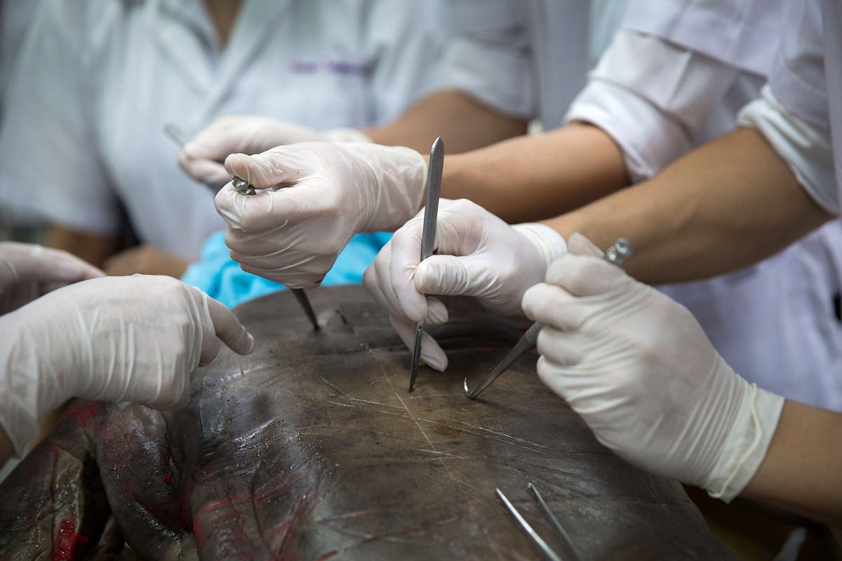 Medical students stumble upon strange case of man with three penises