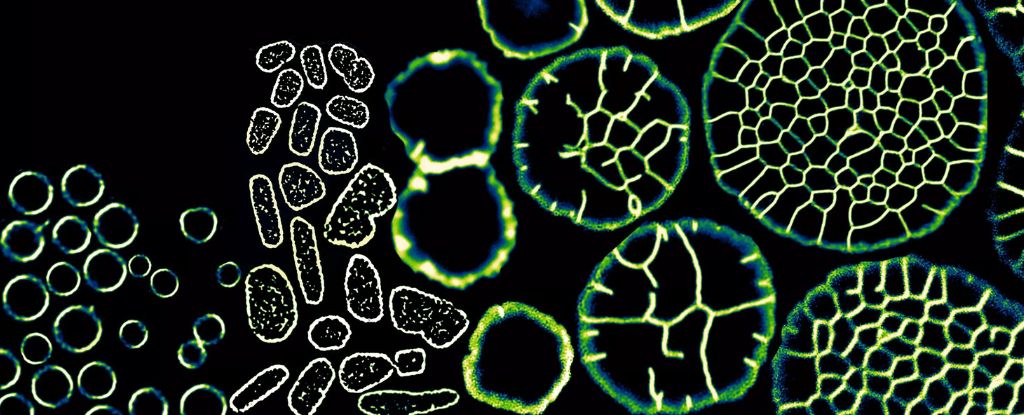 This Single-Celled Microbe Can Transform Into a Multicellular Creature : ScienceAlert