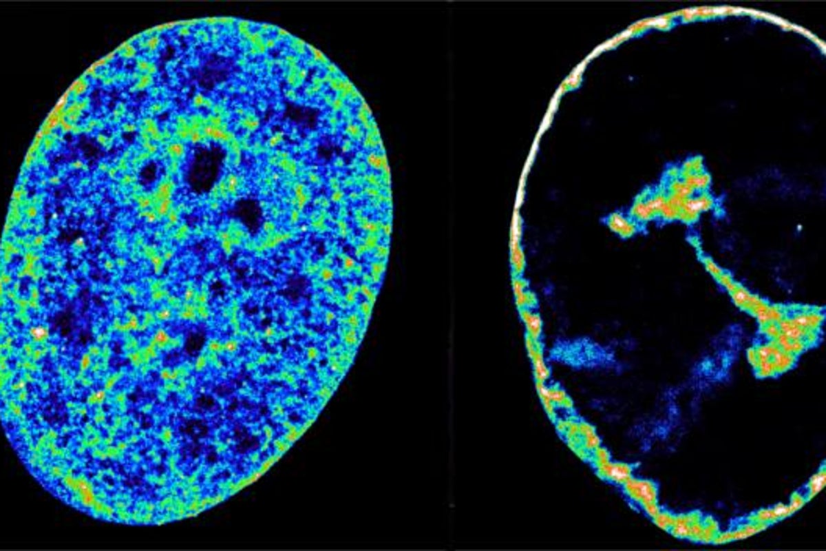 Herpes virus hijacks human DNA within just one hour of infection, scientists find