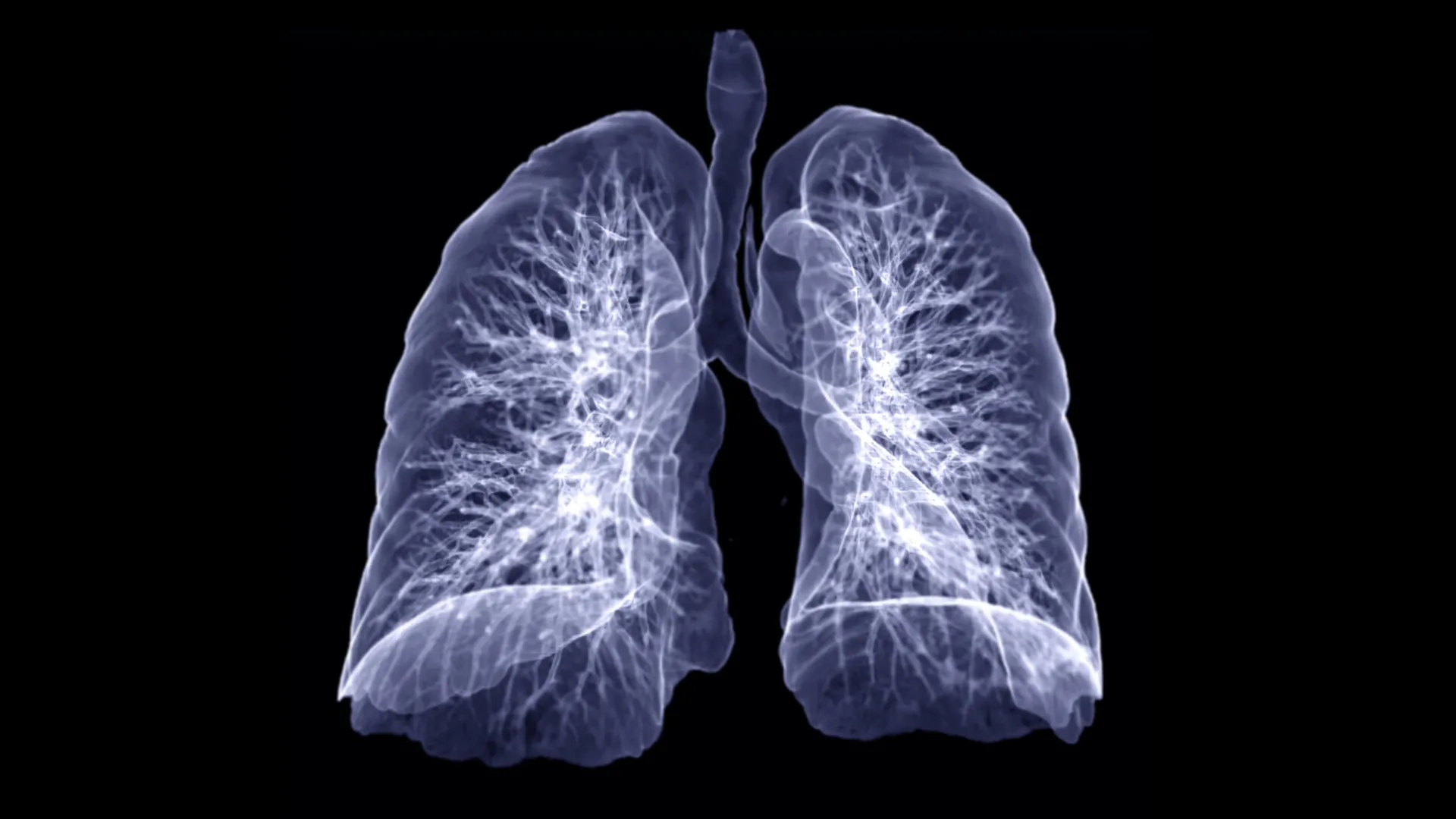 Why asthma often comes back—even with powerful drugs