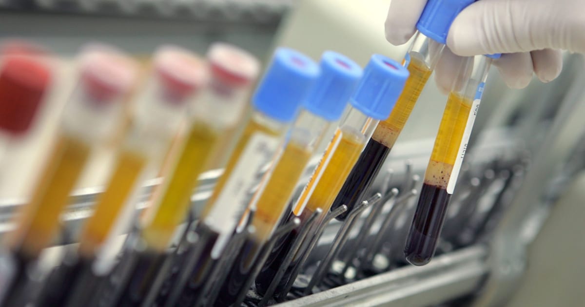 Every Dutch person has ‘forever chemicals’ in their blood – POLITICO