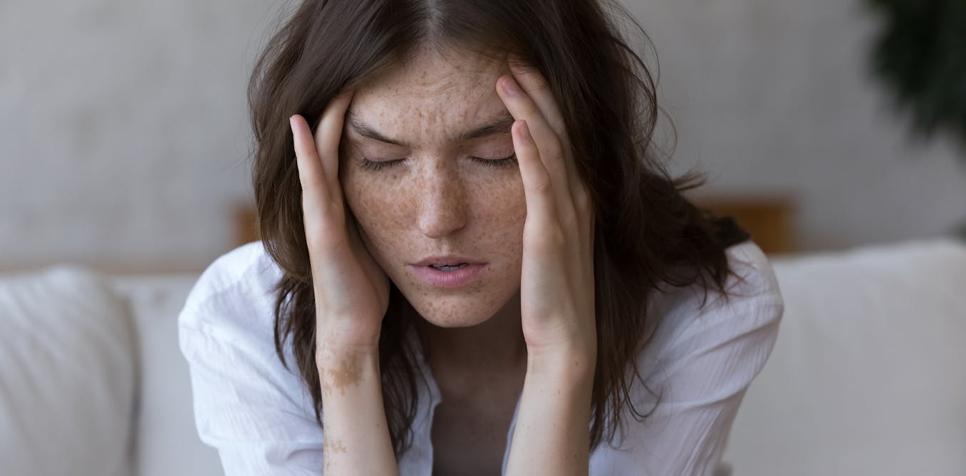 How weather changes cause migraines – a neurologist explains the triggers and what you can do to ease the pain