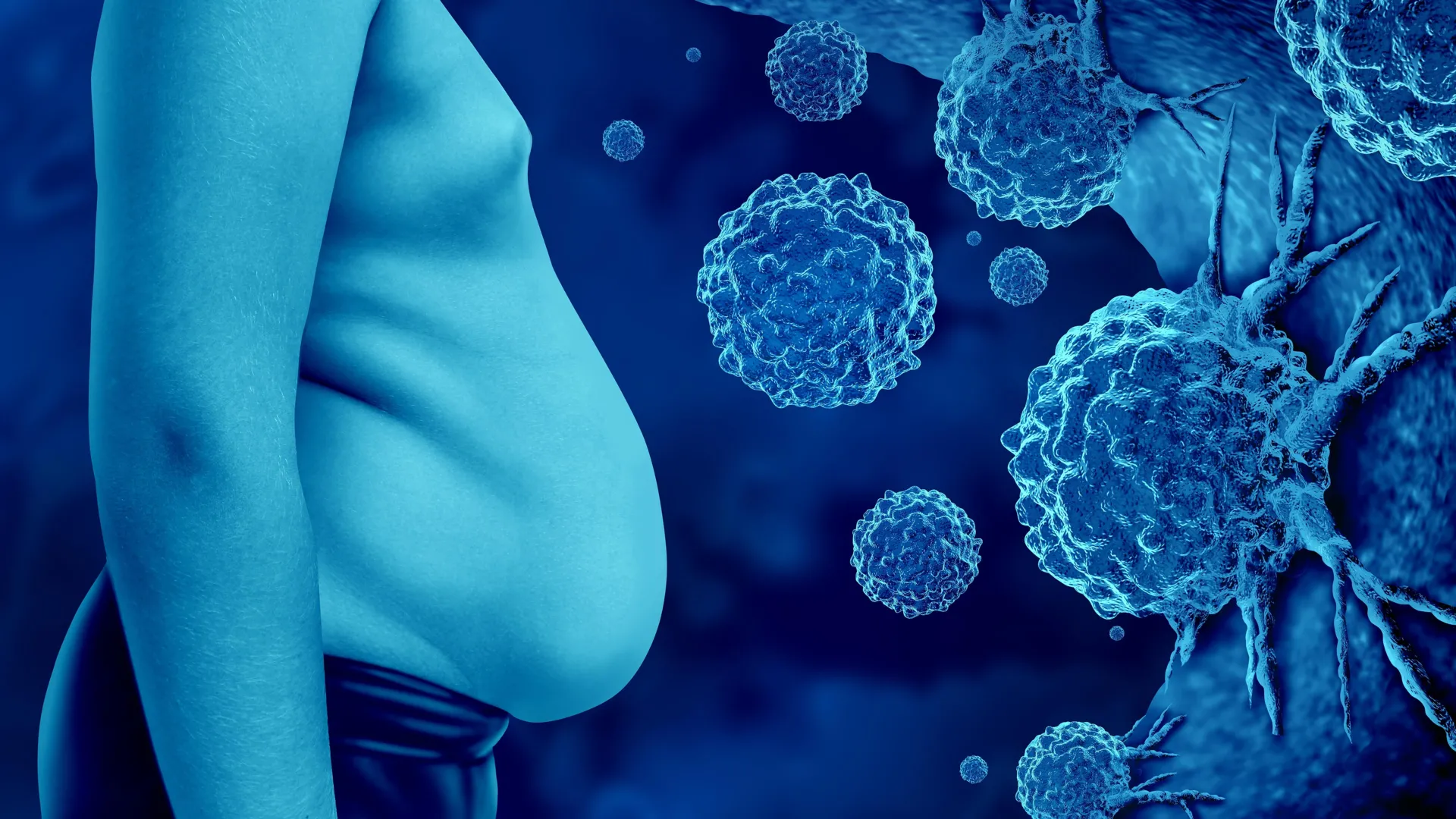 Obesity is driving a hidden cancer epidemic—13 types and rising deaths nationwide