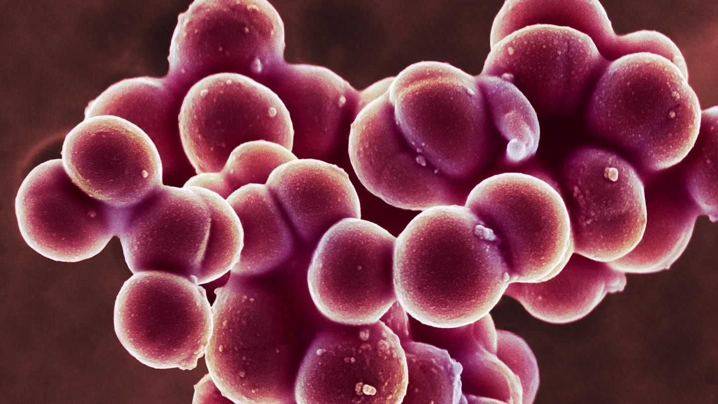 Staph bacteria are bad at letting go