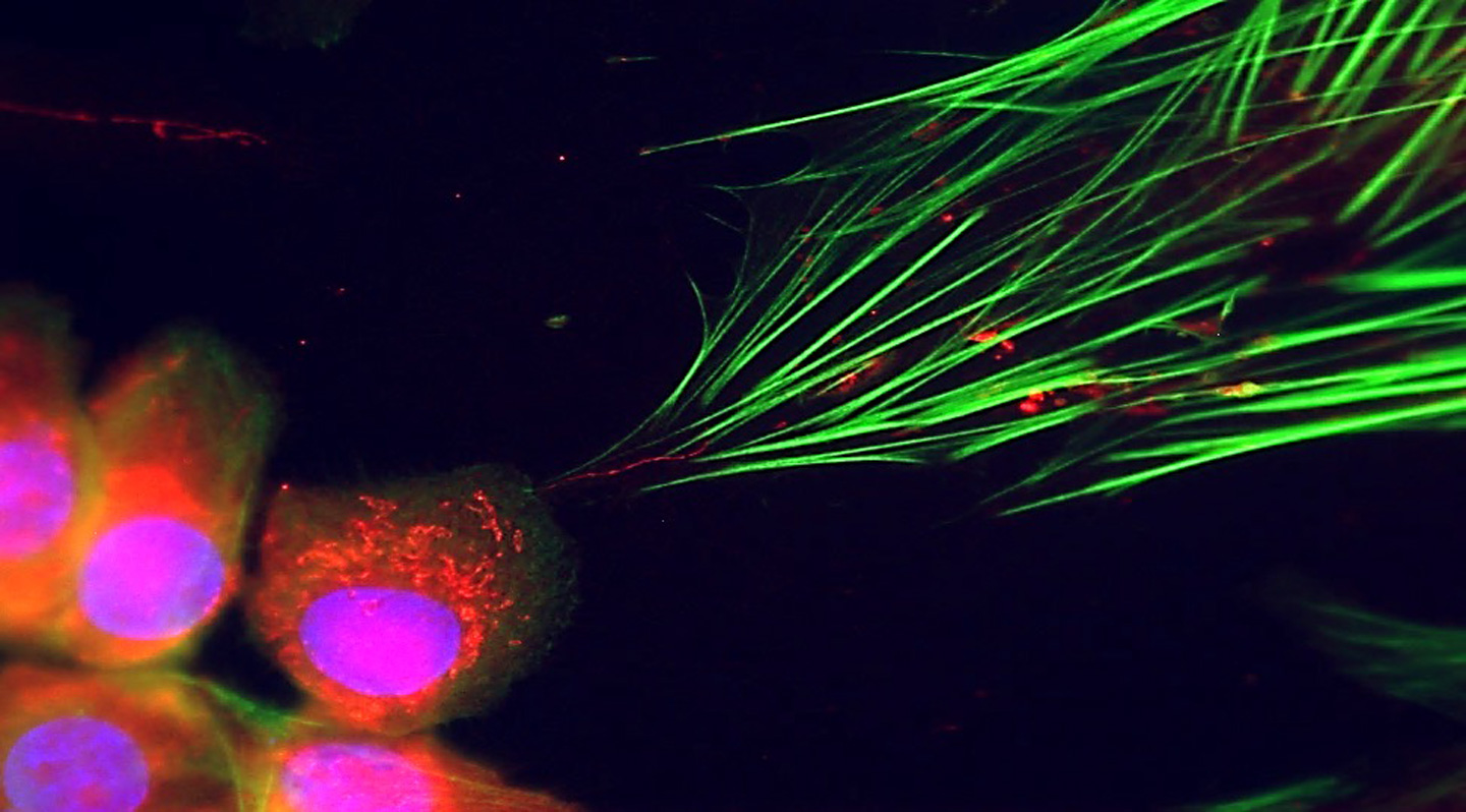 Cancer uses mitochondria to reprogram neighboring cells