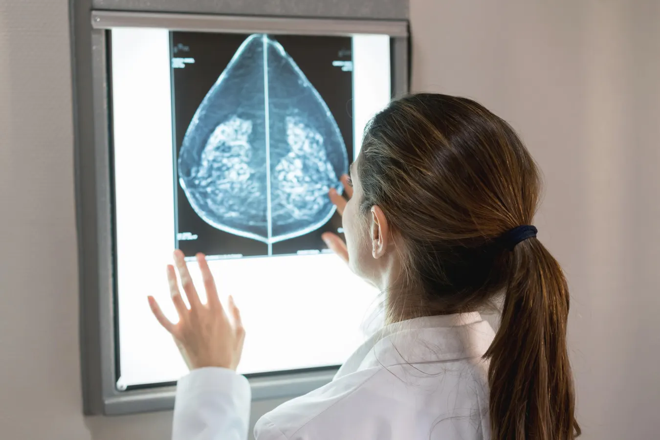 How AI Is Changing Mammograms And Breast Cancer Screening Right Now