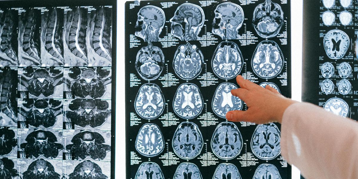 Poor Sleep Linked to Faster Brain Aging