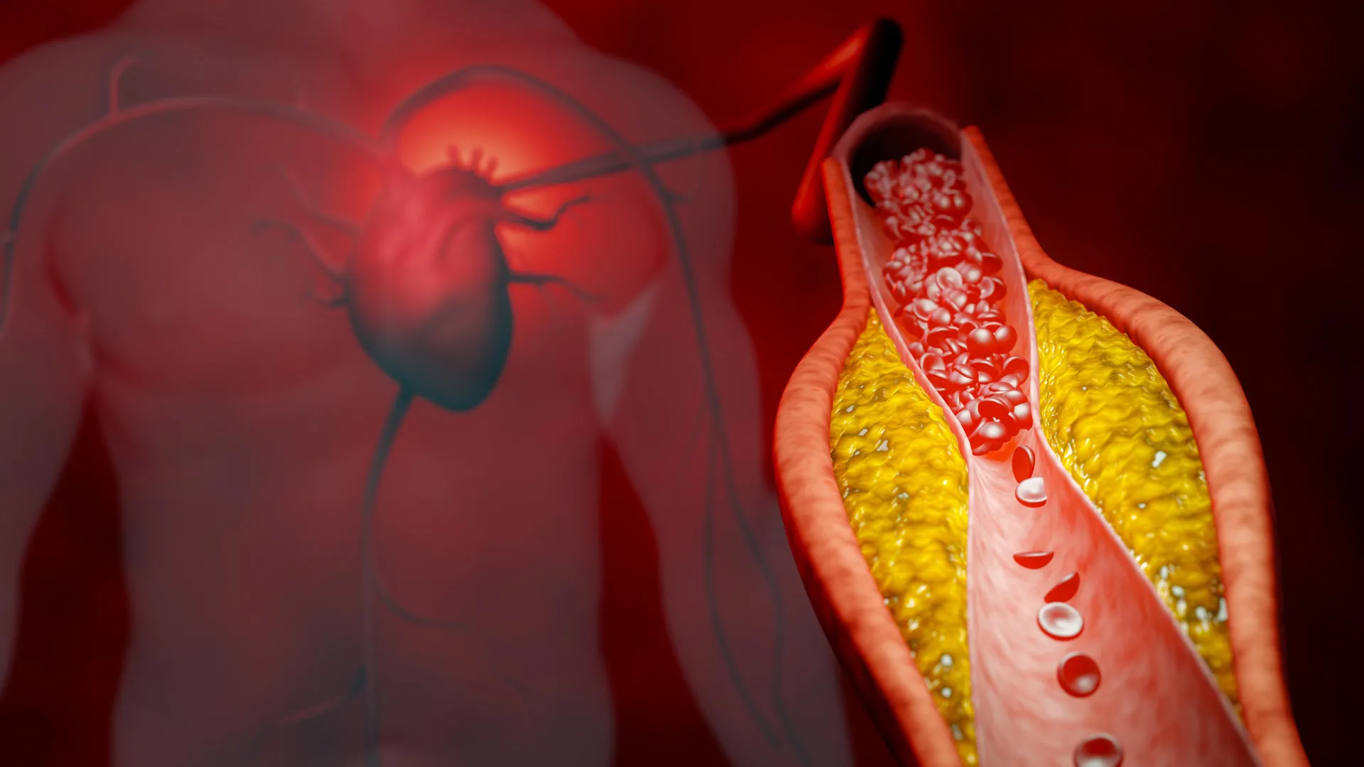 New treatment cuts cholesterol by nearly 50%, without statins or side effects