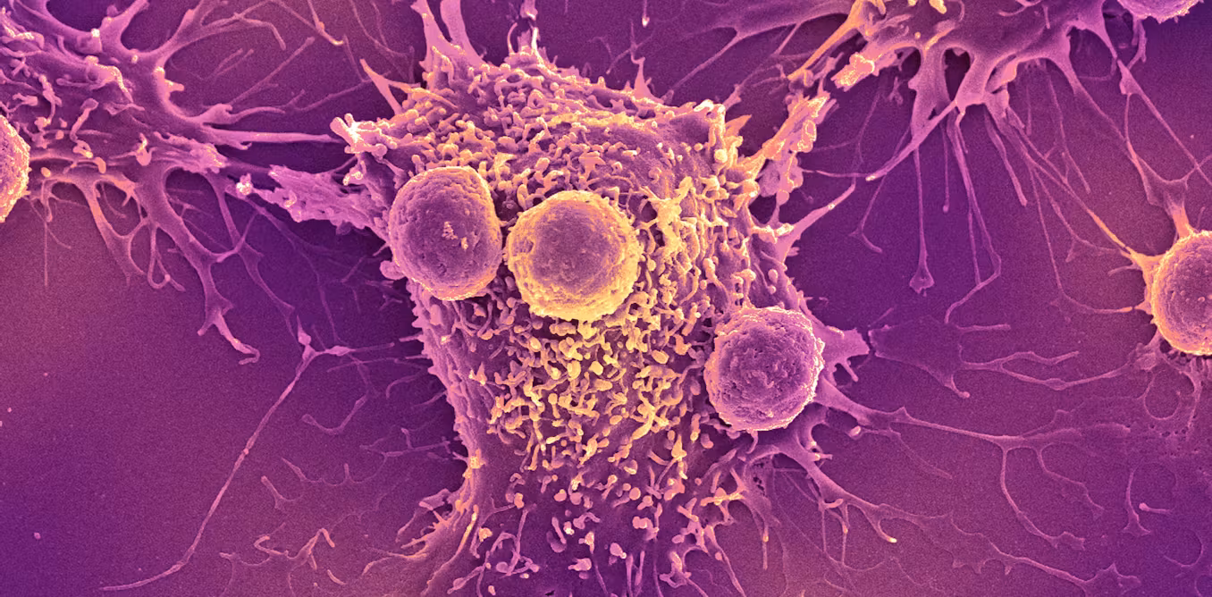 COVID-19 mRNA vaccines could unlock the next revolution in cancer treatment – new research