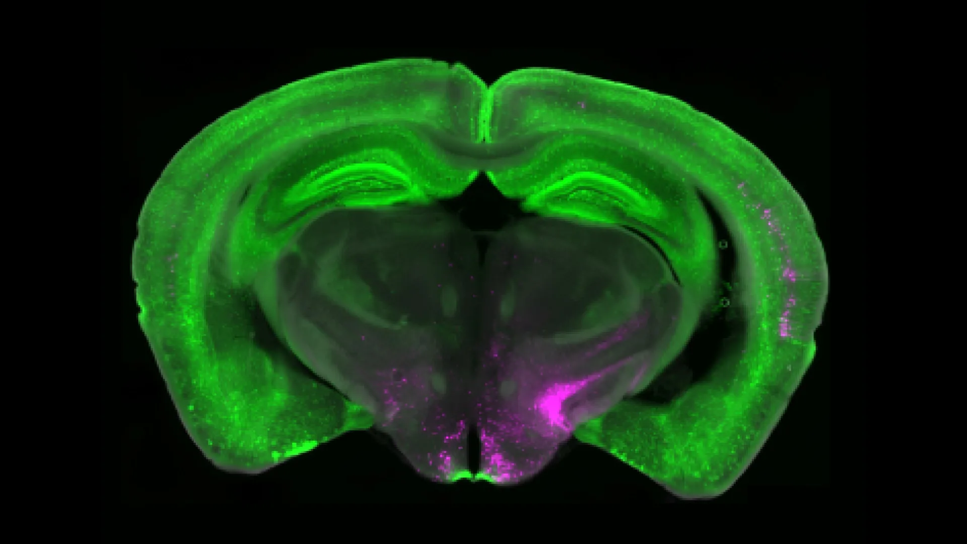 Scientists discover brain circuit that can switch off chronic pain