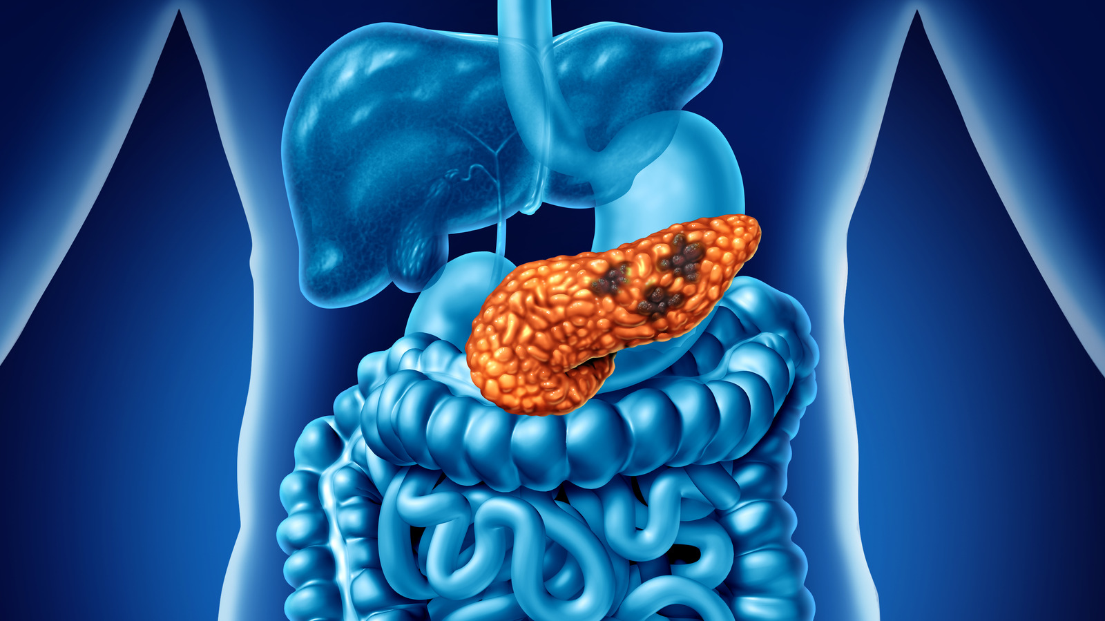 The Pathway Causing Pancreatic Cancer Spread Was Identified, Here’s What That Means