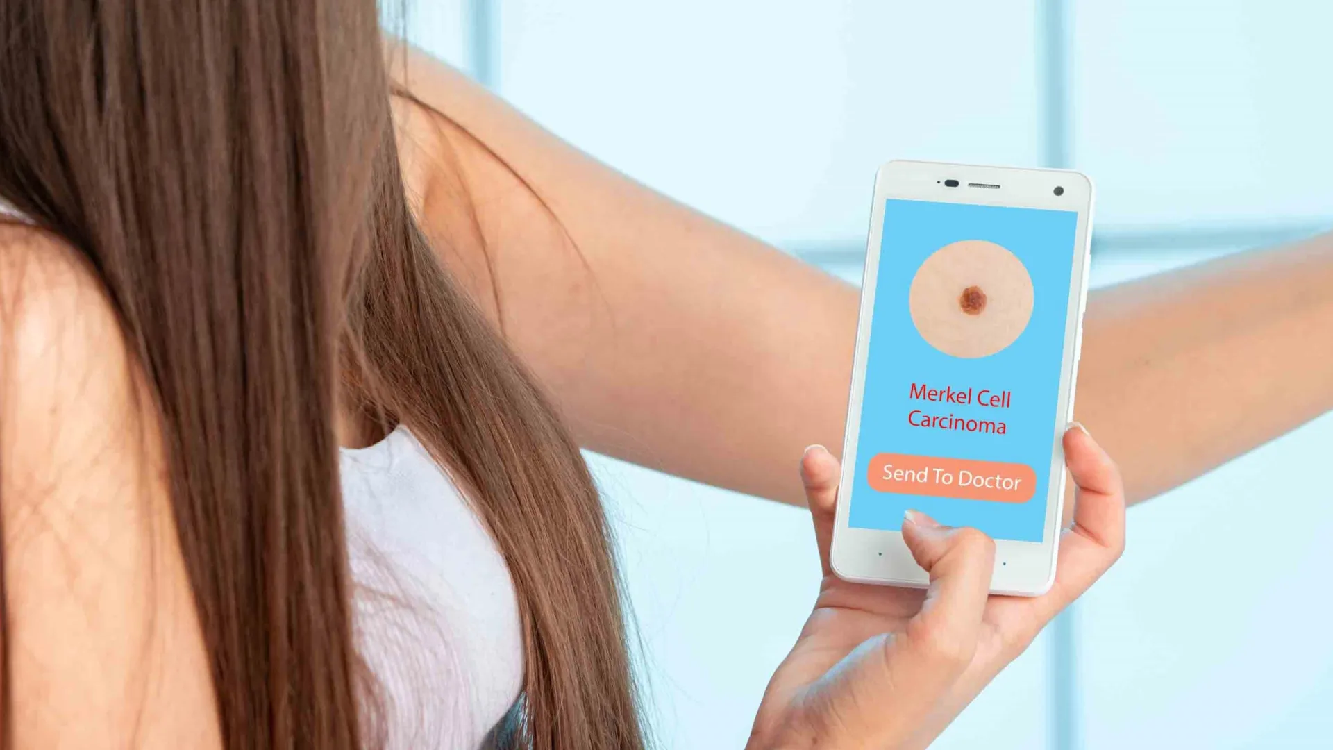 Scientists find immune drug that could halt skin cancer’s deadly spread