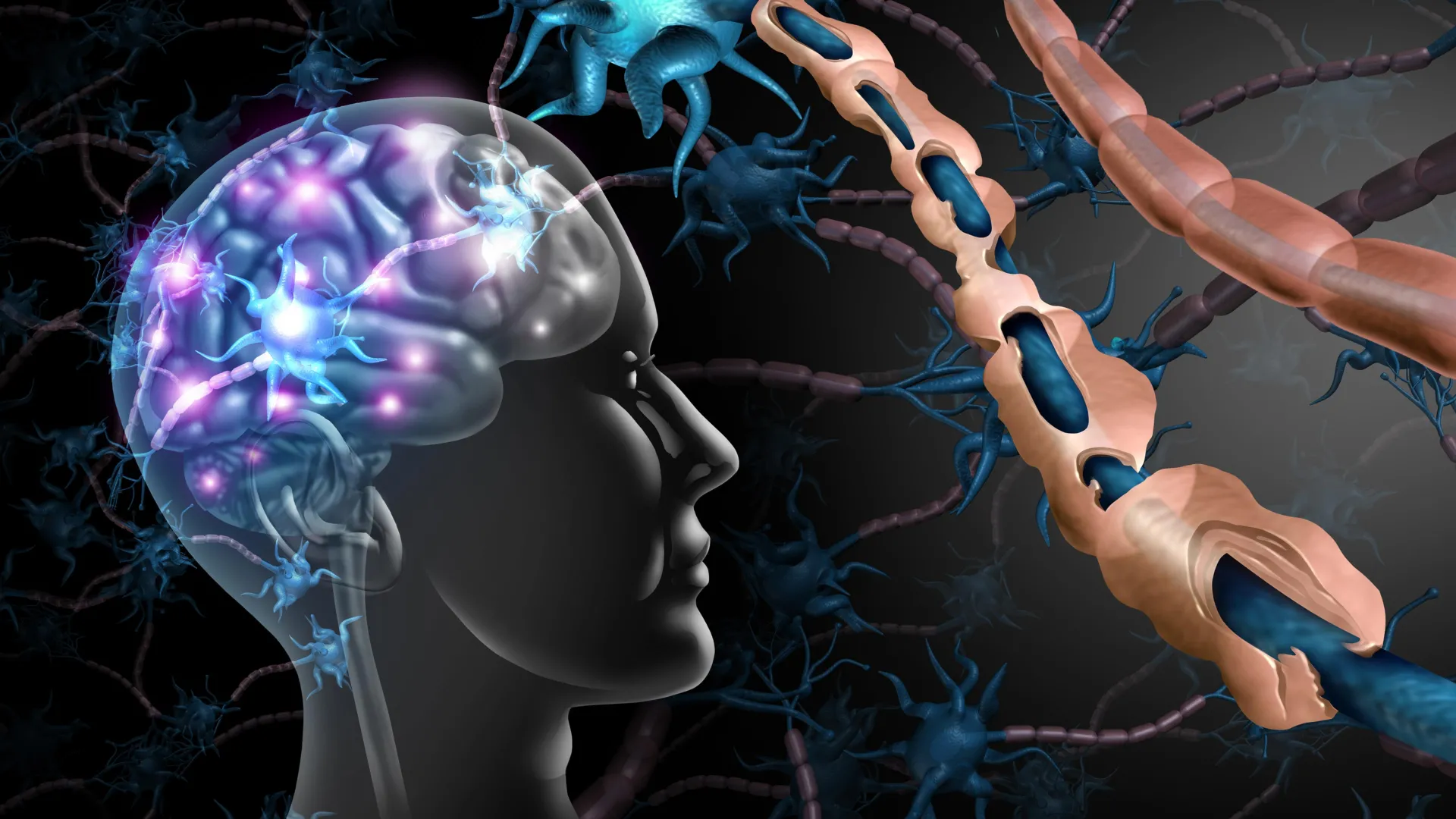 Breakthrough compounds may reverse nerve damage caused by multiple sclerosis