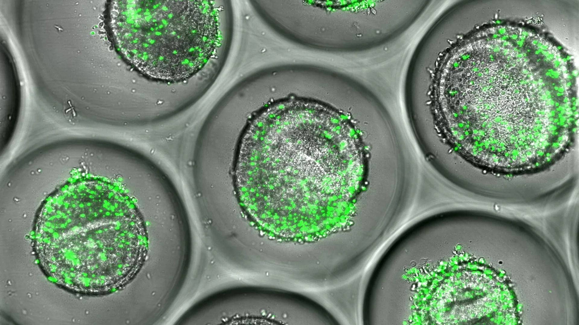 Scientists grow mini human livers that predict toxic drug reactions