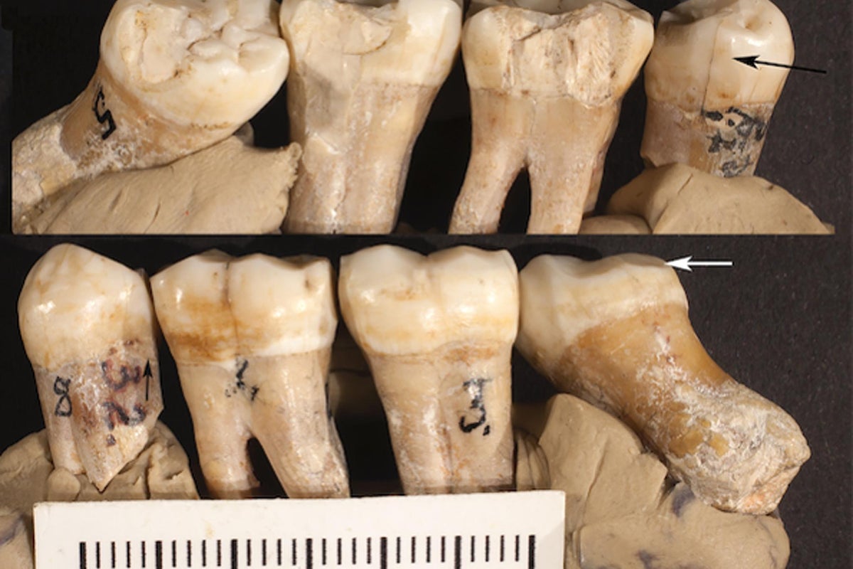Fossil study looking at primates’ teeth challenges long-held idea about human evolution