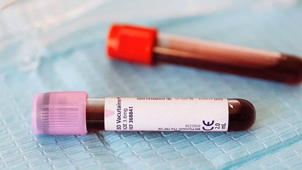 Ethiopia confirms 3 deaths from Ebola-like Marburg virus in new outbreak