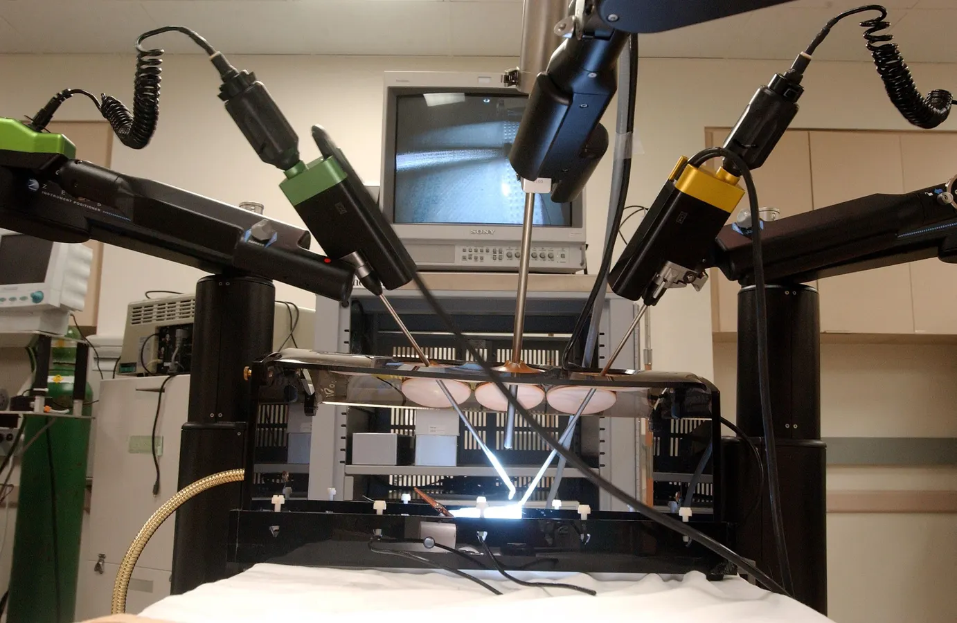 Your Doctor Recommends Robotic Surgery – You Should Be Skeptical