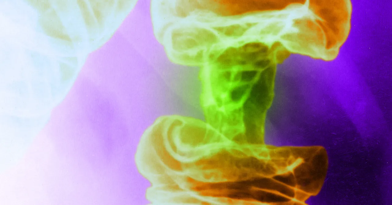 A New Light-Based Cancer Treatment Kills Tumor Cells and Spares Healthy Ones