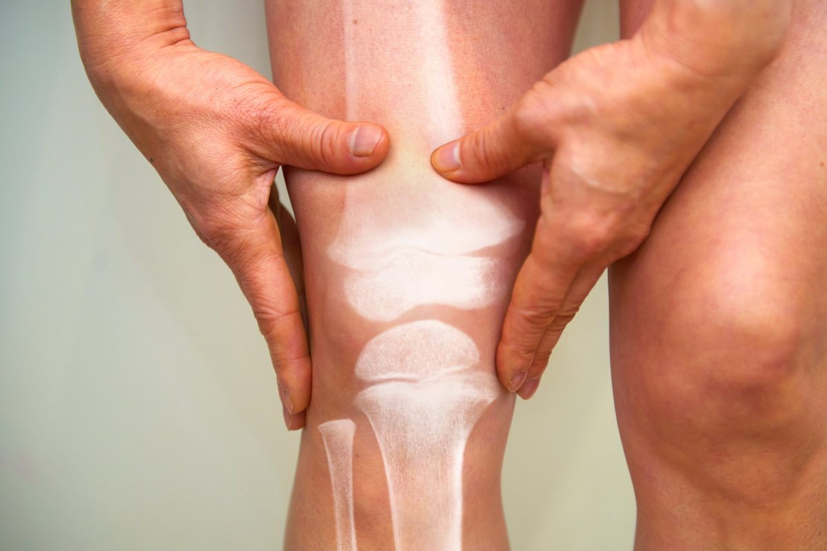 We're on the brink of curing arthritis. Here's how