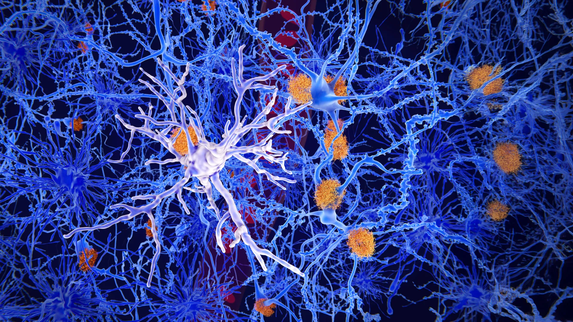 Hidden microglia switch helps protect the brain from Alzheimer’s