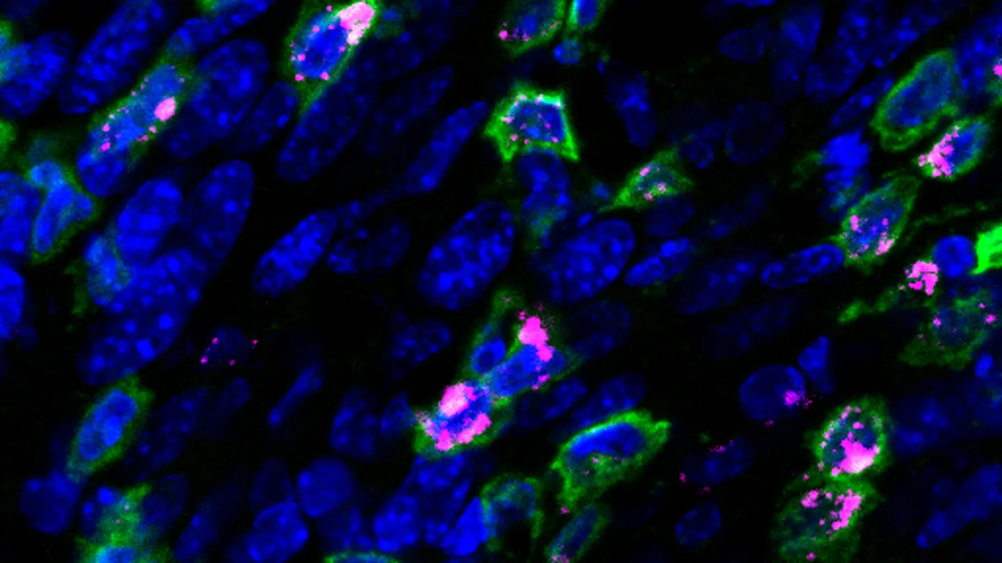 A therapeutic HPV vaccine shrank cervical tumors in mice