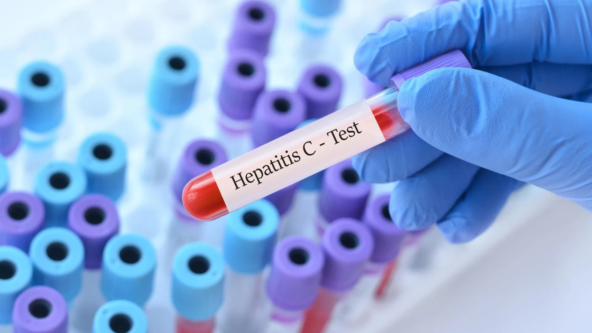This 15 minute hepatitis C test could change everything