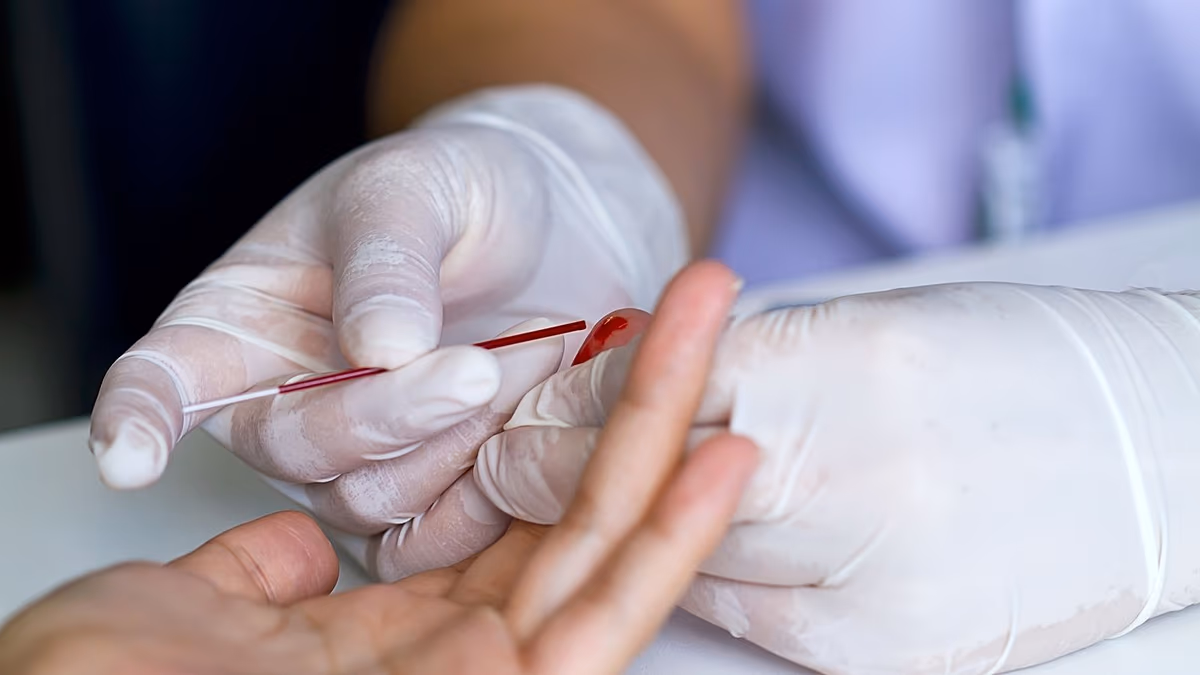 New finger-prick blood test could help detect Alzheimer’s from a home-collected sample