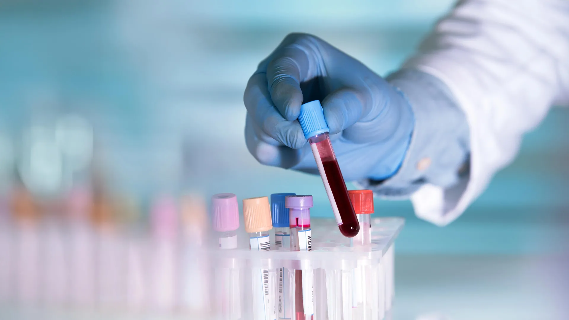 A blood test could reveal Crohn’s disease years before symptoms