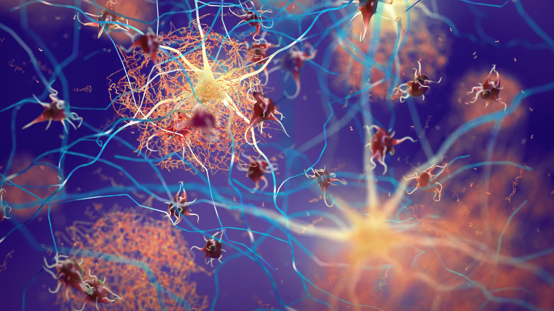 Scientists discover brain switches that clear Alzheimer’s plaques