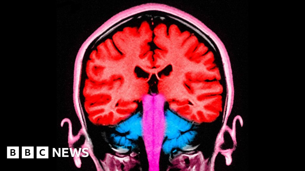 Brain stimulating test makes people 'less selfish' – BBC
