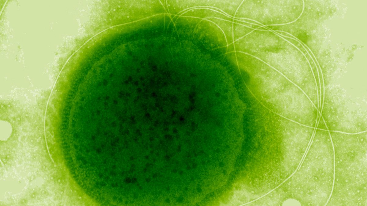 This Extreme Radiation-Resistant Organism Evolved a Remarkable Ability : ScienceAlert