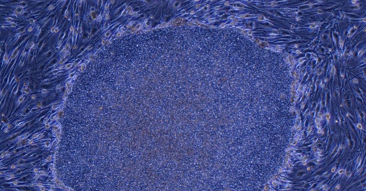 Japan Approves the World’s First Treatment Made With Reprogrammed Human Cells