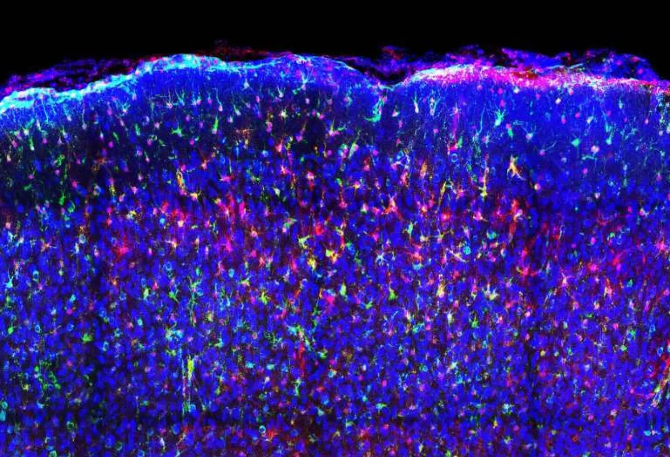 A New Tool To Peer Inside The Cell