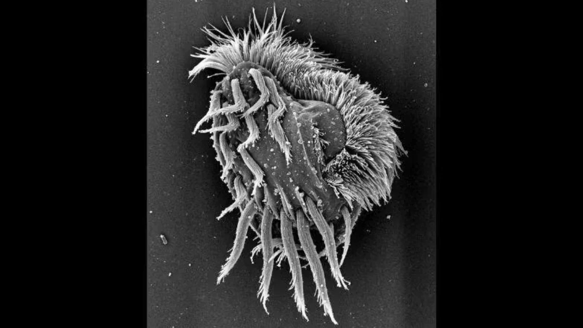 Newly Discovered Microbe Turns Into a Cannibalistic ‘Supergiant’ : ScienceAlert