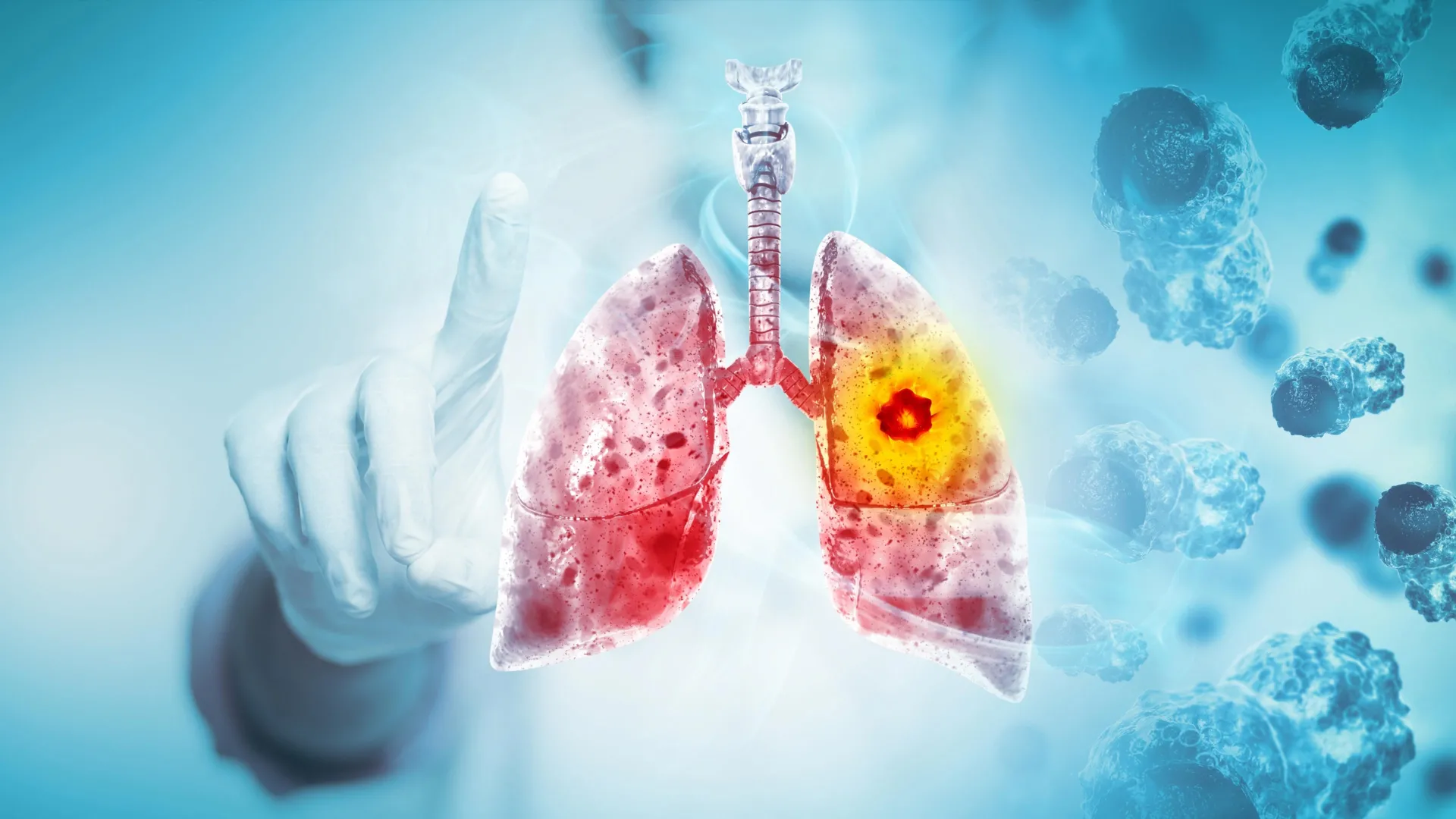 Major review finds vaping likely causes lung and oral cancer