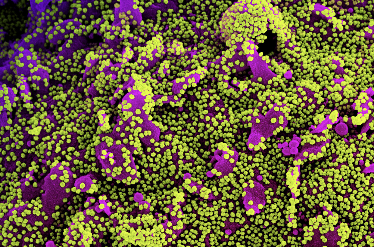 A Novel Pathway Boosts COVID-19 & Drives Lung Damage