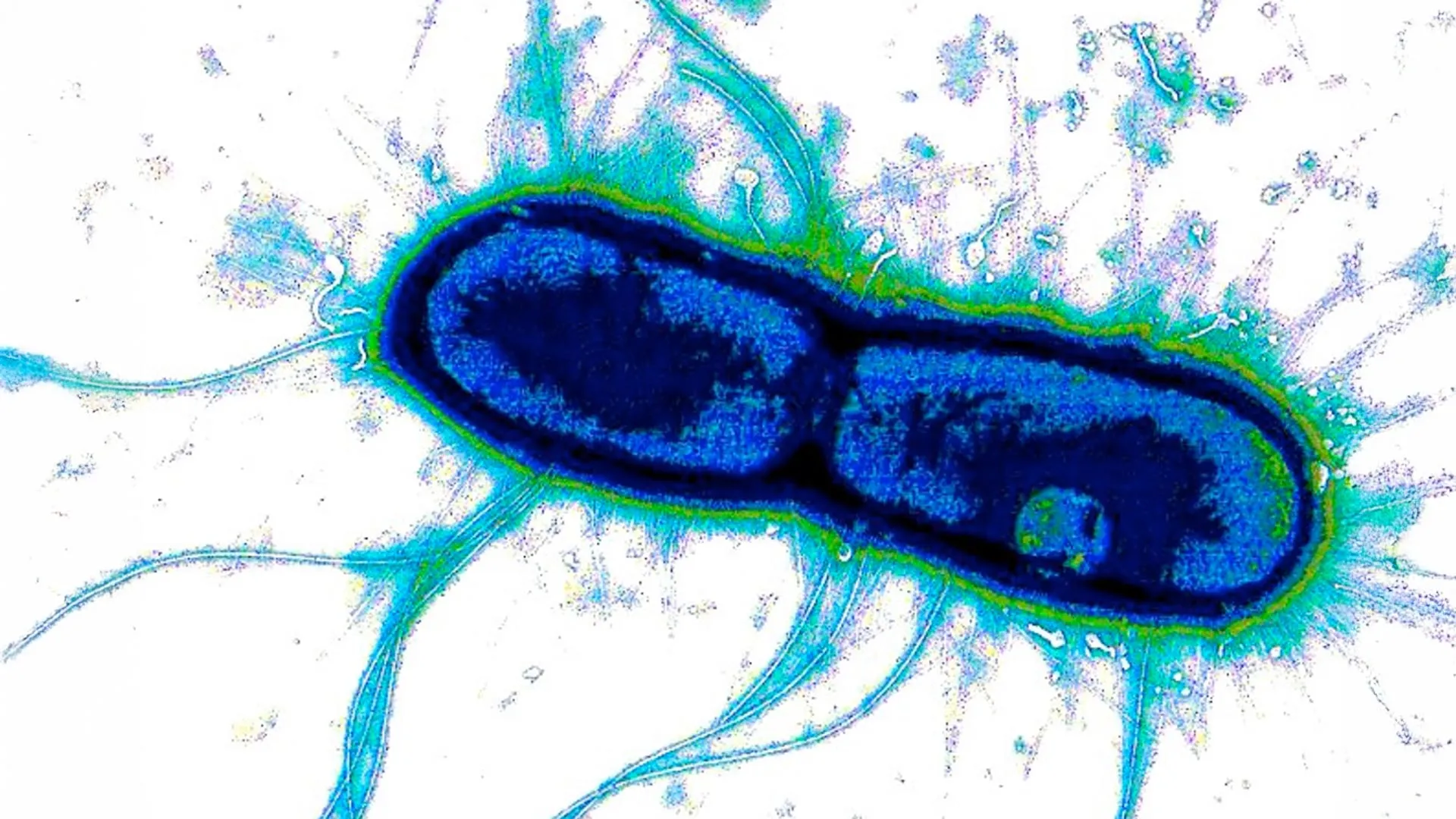 Scientists find the “Achilles’ heel” of deadly gut bacteria