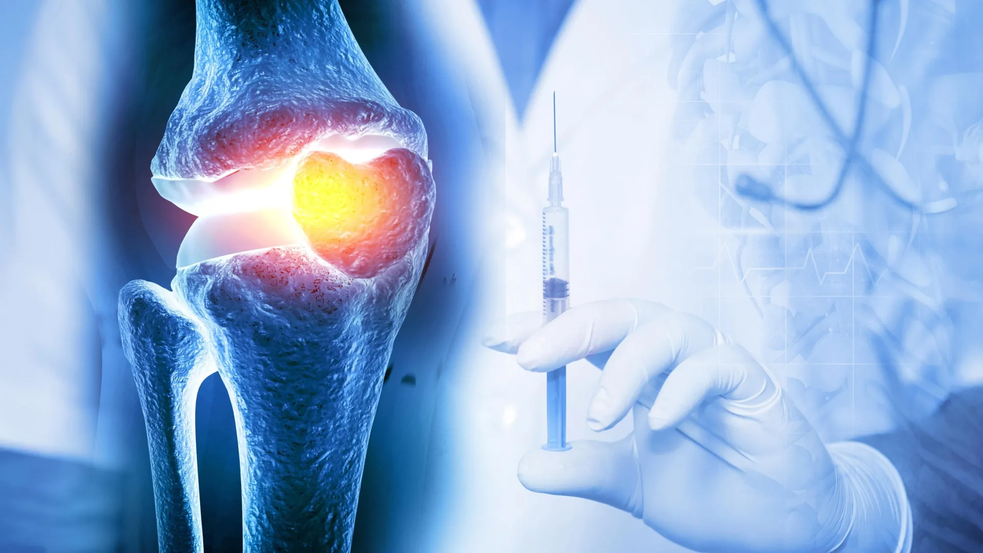 One injection reversed osteoarthritis in weeks